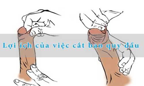 Lợi ích của việc cắt bao quy đầu hẹp